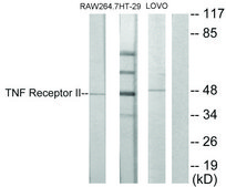 Anti-TNF Receptor II, antibody produced in rabbit affinity isolated antibody