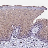 Anti-CARS2 antibody produced in rabbit Prestige Antibodies&#174; Powered by Atlas Antibodies, affinity isolated antibody, buffered aqueous glycerol solution