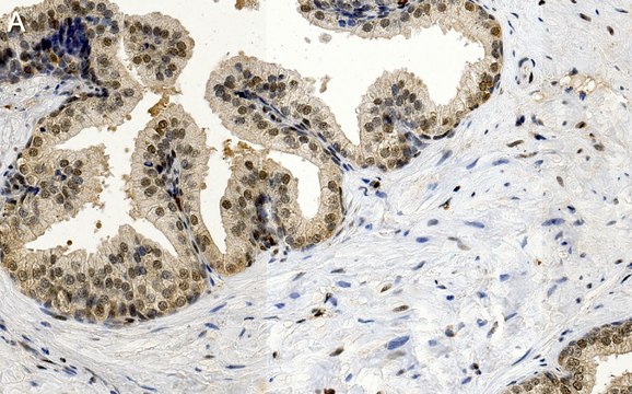 Anti-FGF-2/basic FGF Antibody, clone 1K19 ZooMAb&#174; Rabbit Monoclonal recombinant, expressed in HEK 293 cells