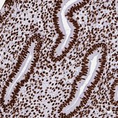 Anti-SFPQ antibody produced in rabbit Prestige Antibodies&#174; Powered by Atlas Antibodies, affinity isolated antibody, buffered aqueous glycerol solution