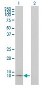 Monoclonal Anti-APOC1 antibody produced in mouse clone 2E2-1A3, purified immunoglobulin, buffered aqueous solution
