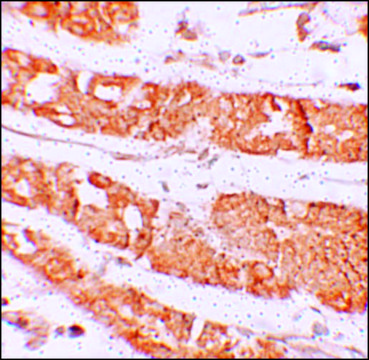 Anti-HMMR antibody produced in rabbit affinity isolated antibody