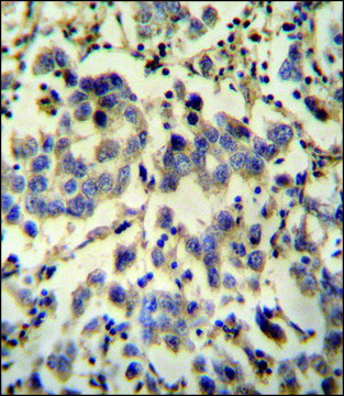 ANTI-C6ORF58 (CENTER) antibody produced in rabbit IgG fraction of antiserum, buffered aqueous solution