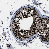 Anti-NPM1 antibody produced in rabbit Prestige Antibodies&#174; Powered by Atlas Antibodies, affinity isolated antibody, buffered aqueous glycerol solution