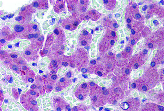 Anti-TFR2 (ab2) antibody produced in rabbit affinity isolated antibody