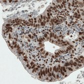 Monoclonal Anti-ERCC1 antibody produced in mouse Prestige Antibodies&#174; Powered by Atlas Antibodies, clone CL1284, purified immunoglobulin, buffered aqueous glycerol solution