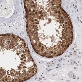 Anti-ADSL antibody produced in rabbit Prestige Antibodies&#174; Powered by Atlas Antibodies, affinity isolated antibody, buffered aqueous glycerol solution