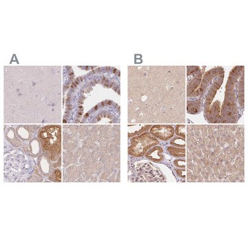 Anti-WDR54 antibody produced in rabbit Prestige Antibodies&#174; Powered by Atlas Antibodies, affinity isolated antibody, buffered aqueous glycerol solution