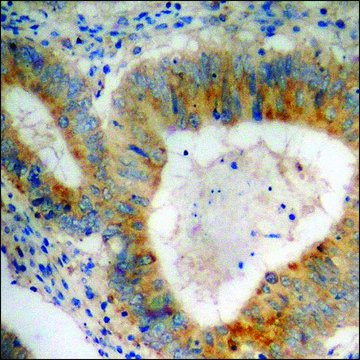 Anti-phospho-p70 S6 Kinase (pThr389) antibody produced in rabbit affinity isolated antibody