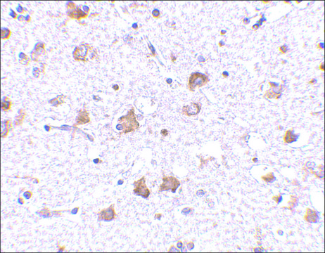 Anti-MANF antibody produced in rabbit affinity isolated antibody, buffered aqueous solution