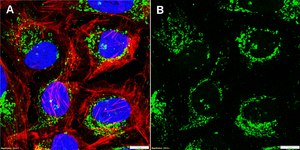 Anti-TFAM Antibody, clone 1C10 ZooMAb&#174; Rabbit Monoclonal recombinant, expressed in HEK 293 cells