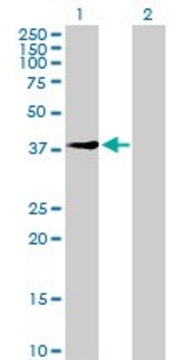 Anti-UEVLD antibody produced in mouse purified immunoglobulin, buffered aqueous solution