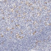 Anti-ITGAX antibody produced in rabbit Prestige Antibodies&#174; Powered by Atlas Antibodies, affinity isolated antibody, buffered aqueous glycerol solution