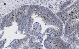 Anti-phospho-Smad2 (Ser465/467) Antibody, clone A5S, ZooMAb&#174; Rabbit Monoclonal recombinant, expressed in HEK 293 cells