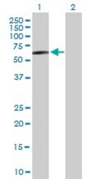 Anti-STK33 antibody produced in mouse purified immunoglobulin, buffered aqueous solution