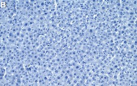 Anti-C1QA Antibody, clone 1M12 ZooMAb&#174; Rabbit Monoclonal recombinant, expressed in HEK 293 cells