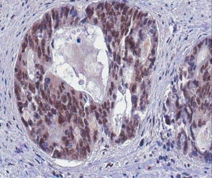 Anti-GADD45 alpha Antibody from rabbit, purified by affinity chromatography