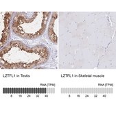 Anti-LZTFL1 antibody produced in rabbit Prestige Antibodies&#174; Powered by Atlas Antibodies, affinity isolated antibody, buffered aqueous glycerol solution