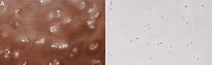 Anti-Collagen Type II Antibody, clone 1K11 ZooMAb&#174; Rabbit Monoclonal recombinant, expressed in HEK 293 cells