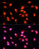 Anti-METTL3 antibody produced in rabbit