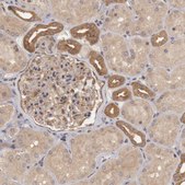 Anti-BRAF antibody produced in rabbit Prestige Antibodies&#174; Powered by Atlas Antibodies, affinity isolated antibody, buffered aqueous glycerol solution