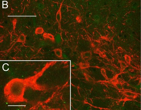 Anti-CAR Antibody, clone RmcB clone RmcB, Upstate&#174;, from mouse