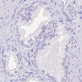 Monoclonal Anti-ARG1 antibody produced in mouse Prestige Antibodies&#174; Powered by Atlas Antibodies, clone CL0186, purified immunoglobulin, buffered aqueous glycerol solution