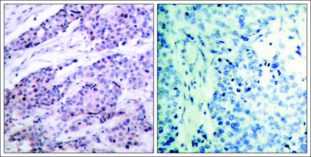 Anti-BCL2 (Ab-56) antibody produced in rabbit affinity isolated antibody