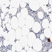 Anti-ITGA2B antibody produced in rabbit Prestige Antibodies&#174; Powered by Atlas Antibodies, affinity isolated antibody, buffered aqueous glycerol solution