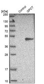 Anti-QPCT antibody produced in rabbit Prestige Antibodies&#174; Powered by Atlas Antibodies, affinity isolated antibody, buffered aqueous glycerol solution