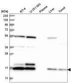Anti-UBE2C antibody produced in rabbit Prestige Antibodies&#174; Powered by Atlas Antibodies, affinity isolated antibody
