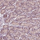 Anti-NUP210 antibody produced in rabbit Prestige Antibodies&#174; Powered by Atlas Antibodies, affinity isolated antibody, buffered aqueous glycerol solution