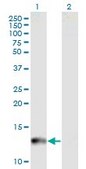 Monoclonal Anti-CYP24A1 antibody produced in mouse clone 1F8, purified immunoglobulin, buffered aqueous solution