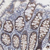 Anti-CHCHD10 antibody produced in rabbit Prestige Antibodies&#174; Powered by Atlas Antibodies, affinity isolated antibody, buffered aqueous glycerol solution