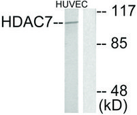 Anti-HDAC7 antibody produced in rabbit affinity isolated antibody