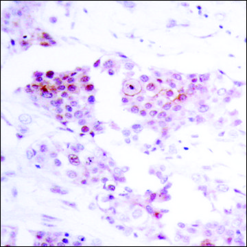 Anti-MEF2A (Ab-319) antibody produced in rabbit affinity isolated antibody