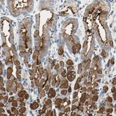 Anti-MUC1 antibody produced in rabbit Prestige Antibodies&#174; Powered by Atlas Antibodies, affinity isolated antibody, buffered aqueous glycerol solution