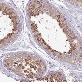 Anti-DPF1 antibody produced in rabbit Prestige Antibodies&#174; Powered by Atlas Antibodies, affinity isolated antibody, buffered aqueous glycerol solution