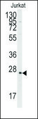 Anti-RND1 (C-term) antibody produced in rabbit saturated ammonium sulfate (SAS) precipitated, buffered aqueous solution