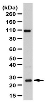 Anti-RAB8A Antibody from rabbit, purified by affinity chromatography