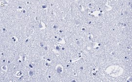 Anti-Prion Protein Antibody, clone 3D17 ZooMAb&#174; Rabbit Monoclonal recombinant, expressed in HEK 293 cells