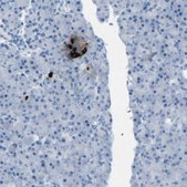 Anti-SST antibody produced in rabbit affinity isolated antibody, buffered aqueous glycerol solution