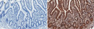 Anti-AMPK alpha Antibody, clone 2D22, ZooMAb&#174; Rabbit Monoclonal recombinant, expressed in HEK 293 cells