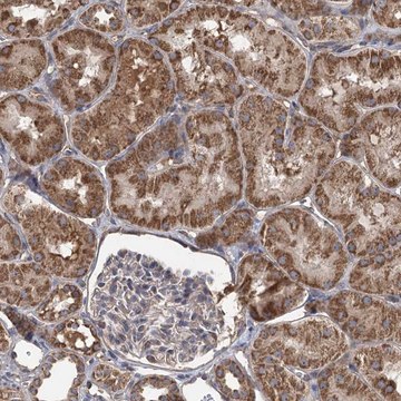 Anti-RWDD4 antibody produced in rabbit Prestige Antibodies&#174; Powered by Atlas Antibodies, affinity isolated antibody, buffered aqueous glycerol solution