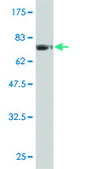 Monoclonal Anti-FLI1 antibody produced in mouse clone 2G8, purified immunoglobulin, buffered aqueous solution