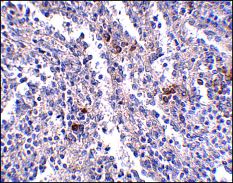 Anti-SYPL2 antibody produced in rabbit affinity isolated antibody, buffered aqueous solution