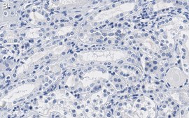 Anti-Na+/K+ ATPase &#945;-1 Antibody, clone C464.6 ZooMAb&#174; Mouse Monoclonal recombinant, expressed in HEK 293 cells