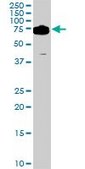Monoclonal Anti-DDX3Y antibody produced in mouse clone 2D7, purified immunoglobulin, buffered aqueous solution