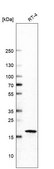 Anti-CDKN1A antibody produced in mouse Prestige Antibodies&#174; Powered by Atlas Antibodies, clone CL13081, purified by using Protein A, buffered aqueous glycerol solution