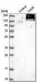 Anti-CASR antibody produced in rabbit Prestige Antibodies&#174; Powered by Atlas Antibodies, affinity isolated antibody, buffered aqueous glycerol solution